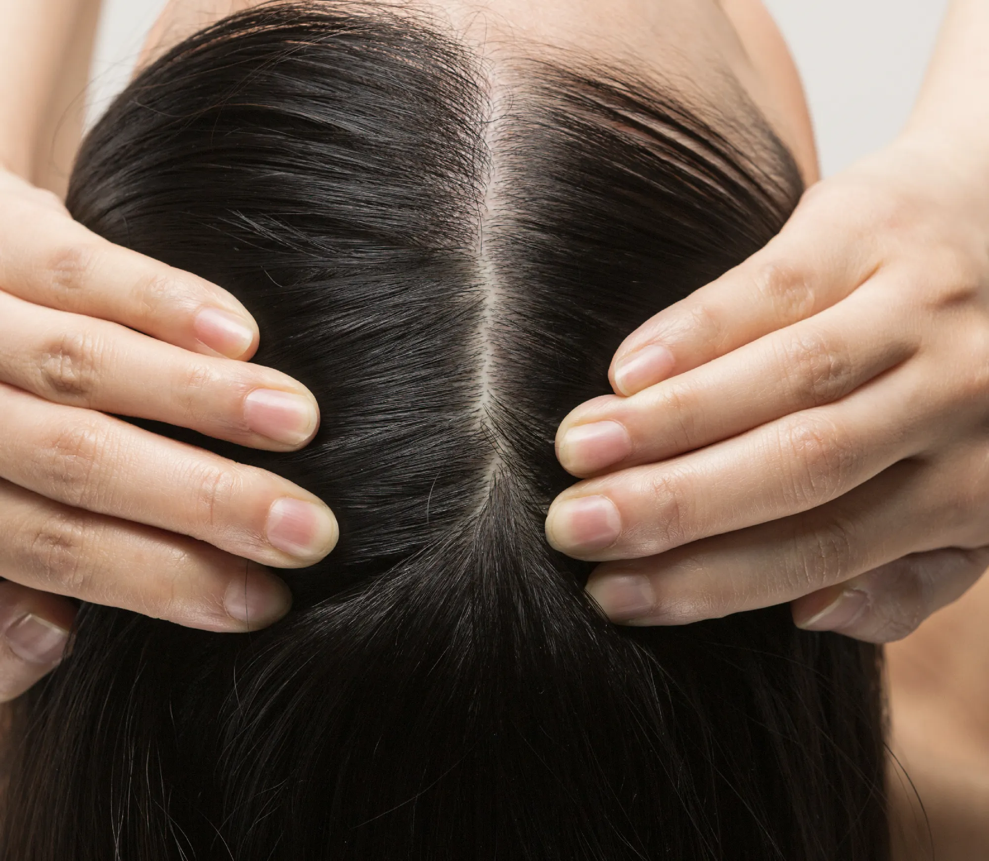 Close-up view of dark hair parted at the center, with hands gently massaging and exposing the scalp.